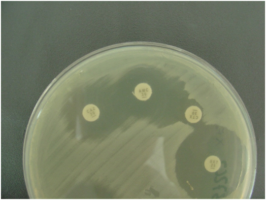 Figura 1:  Test di sensibilità agli antibiotici, dettaglio di una piastra di Muller Hinton Agar