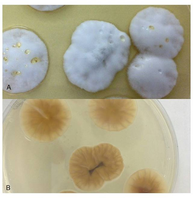 Caso clinico 2. Colonie di Simplicillium sp. su agar destrosio Sabouraud: A) superficie biancastra, con micelio cotonoso; B) fondo giallo-brunastro