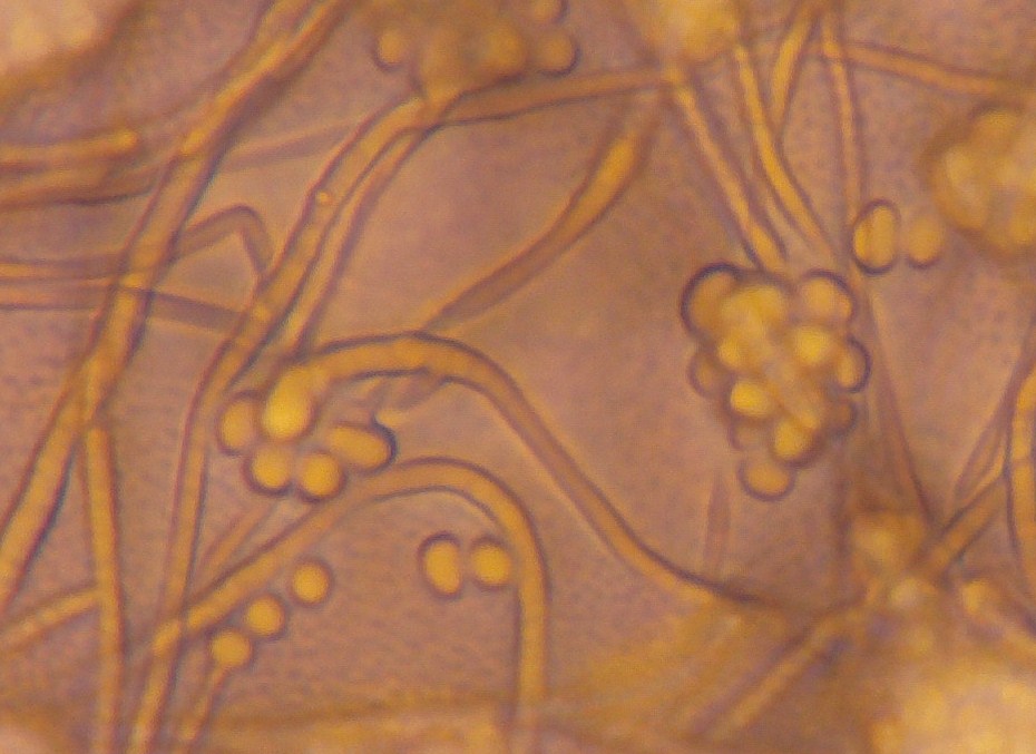 Caratteristiche microscopiche di Simplicillium sp.: ife sottili e ialine, con conidiofori portanti clusters di conidi a singole cellule