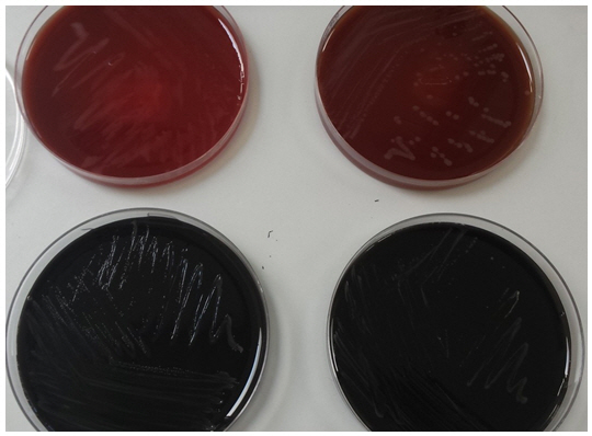 Figura 1. Campylobacter spp. Su Agar Sangue e Karmali