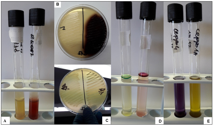 Principali differenze nei test biochimici tra Y. enterocolitica appartenente al biotipo 4 e al biotipo 1A