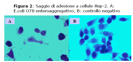 Saggio di adesione a cellule Hep-2. A: E.coli O78 enteroaggregativo; B: controllo negativo