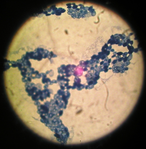 Esame microscopico. Si evidenziano le tipiche cellule ovoidali di Rhodotorula glutinis