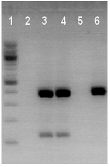 Multiplex PCR results